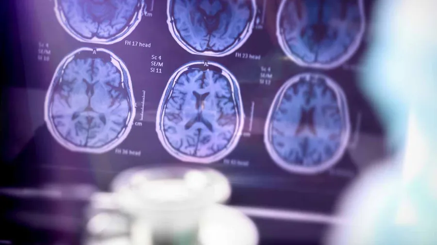 Illinois Becomes First State to Mandate Insurance Coverage for Alzheimer’s Treatment