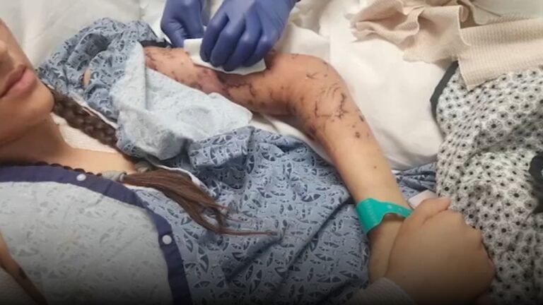 Newberry Springs Man Arrested After Teen Girl Mauled by Pack of Dogs